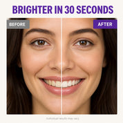 Before and after, brighter smile in 30 seconds, individual results may vary