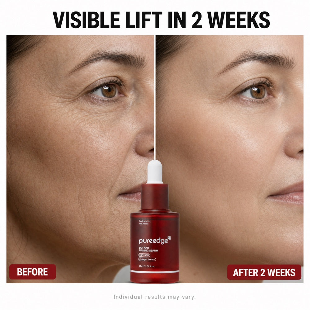 before-after-4.jpg